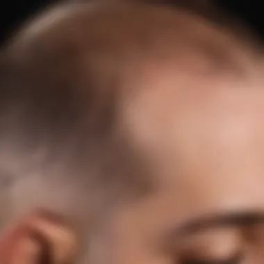 Close-up of micro pigmentation technique in hair restoration tattoo