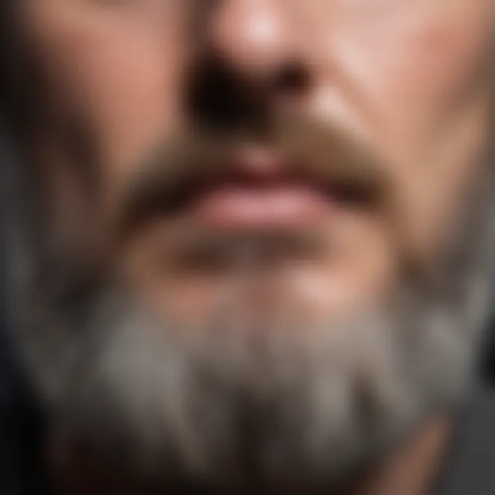 Close-up of dry skin under a beard