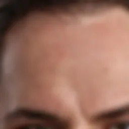 Close-up of clogged hair follicle displaying blackhead formation